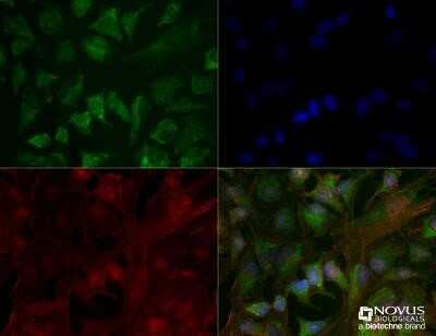 Immunocytochemistry/ Immunofluorescence: CHREBP Antibody (2D9NB) - Azide and BSA Free [NBP2-80669]