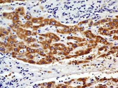 Immunohistochemistry: CHREBP Antibody (2D9NB) - Azide and BSA Free [NBP2-80669]