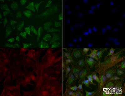 Immunocytochemistry/ Immunofluorescence: CHREBP Antibody (2D9NB) - BSA Free [NBP2-44307]