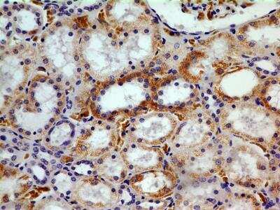 Immunohistochemistry-Paraffin: CHREBP Antibody (2D9NB) - BSA Free [NBP2-44307]