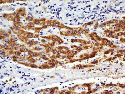 Immunohistochemistry-Paraffin: CHREBP Antibody (2D9NB) - BSA Free [NBP2-44307]