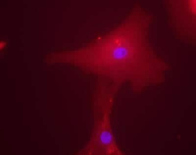 Immunocytochemistry/ Immunofluorescence: CHREBP Antibody [NB400-136]