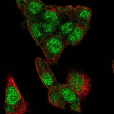 Immunocytochemistry/ Immunofluorescence: CHREBP Antibody [NBP2-56612]