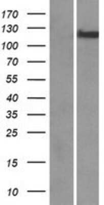 Western Blot: CHREBP Overexpression Lysate [NBP2-05948]