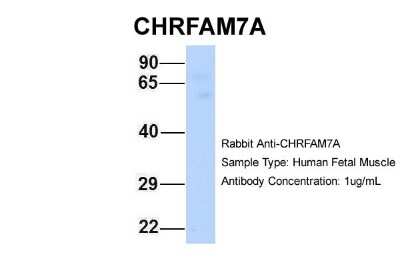 Western Blot: CHRFAM7A Antibody [NBP1-80090]