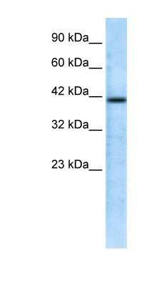 Western Blot: CHRFAM7A Antibody [NBP1-80091]