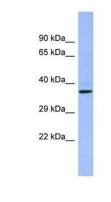 Western Blot: CHRFAM7A Antibody [NBP1-80206]