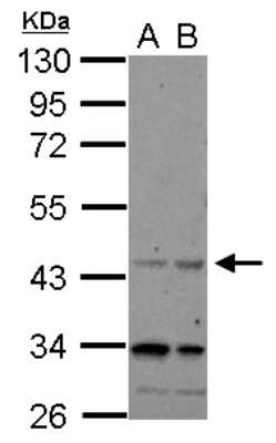 Western Blot: CHRFAM7A Antibody [NBP2-15894]