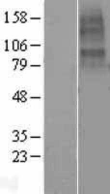 Western Blot: Nicotinic Acetylcholine R alpha 10/CHRNA10 Overexpression Lysate [NBL1-09178]