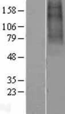 Western Blot: Nicotinic Acetylcholine R alpha 9/CHRNA9 Overexpression Lysate [NBL1-09185]