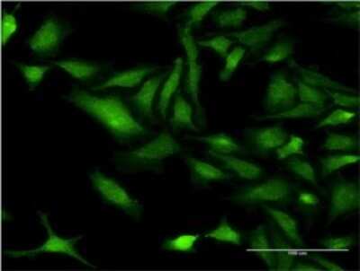 Immunocytochemistry/ Immunofluorescence: CHRNB3 Antibody (3G6) [H00001142-M01]