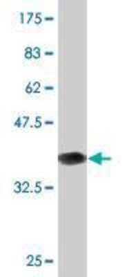 Western Blot: CHRNB3 Antibody (3G6) [H00001142-M01]