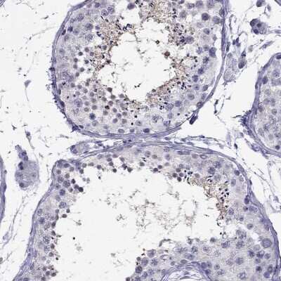 Immunohistochemistry-Paraffin: CHRNB3 Antibody [NBP1-91783]