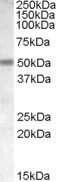 Western Blot: CHRNB3 Antibody [NB100-94886]