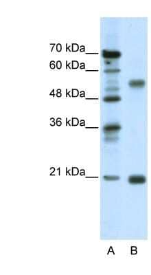 Western Blot: CHRNB3 Antibody [NBP1-79950]