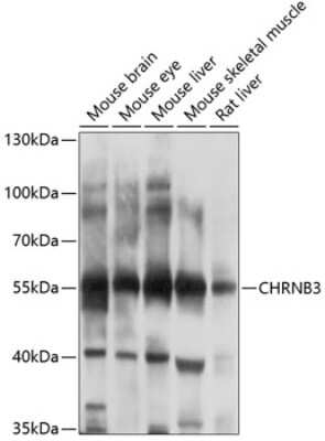 Western Blot: CHRNB3 AntibodyBSA Free [NBP2-91996]