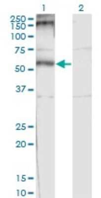 Western Blot: CHRND Antibody (2B2) [H00001144-M01]