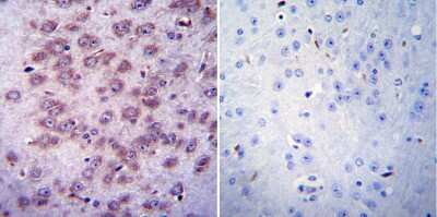 Immunohistochemistry-Paraffin: CHRND Antibody (88B) [NB120-2804]