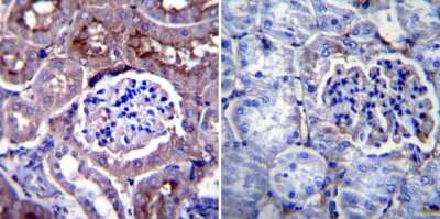 Immunohistochemistry-Paraffin: CHRND Antibody (88B) [NB120-2804]