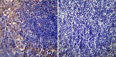 Immunohistochemistry-Paraffin: CHRND Antibody (88B) [NB120-2804]