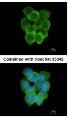 Immunocytochemistry/ Immunofluorescence: CHRND Antibody [NBP1-31248]