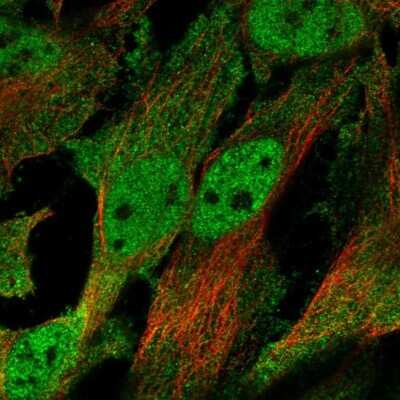 Immunocytochemistry/ Immunofluorescence: CHRND Antibody [NBP2-68725]