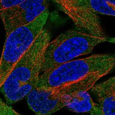 Immunocytochemistry/ Immunofluorescence: CHRND Antibody [NBP2-68832]