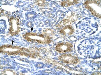 Immunohistochemistry: CHRND Antibody [NBP3-10873]