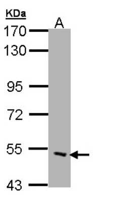 Western Blot: CHRND Antibody [NBP1-31248]