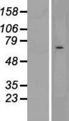 Western Blot: CHRND Overexpression Lysate [NBL1-09190]