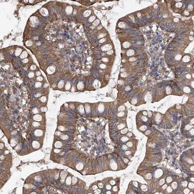 Immunohistochemistry-Paraffin: CHSS2 Antibody [NBP1-88087]