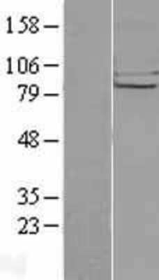 Western Blot: CHSS2 Overexpression Lysate [NBL1-09169]