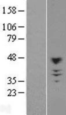 Western Blot: Carbohydrate Sulfotransferase 10/CHST10 Overexpression Lysate [NBL1-09192]