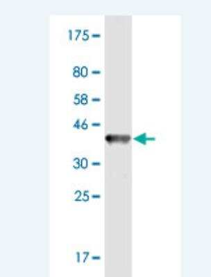 Western Blot: CHST11 Antibody (1H3) [H00050515-M02]