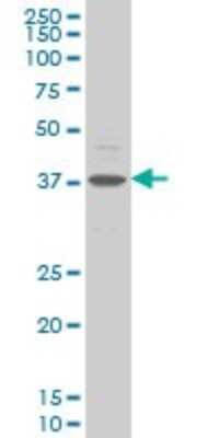 Western Blot: CHST11 Antibody (4F1) [H00050515-M01]