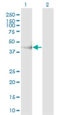 Western Blot: CHST11 Antibody (4F1) [H00050515-M01]