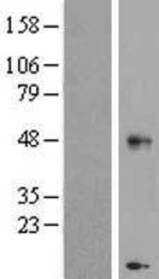 Western Blot: CHST11 Overexpression Lysate [NBL1-09193]