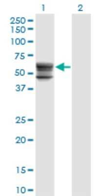 Western Blot: CHST12 Antibody (3D6) [H00055501-M01]