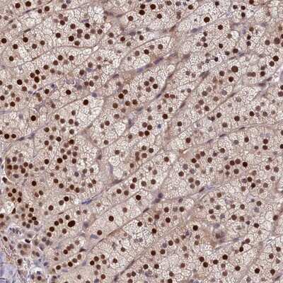 Immunohistochemistry-Paraffin: CHST12 Antibody [NBP1-91784]