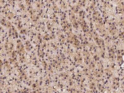Immunohistochemistry-Paraffin: CHST12 Antibody [NBP2-97234]