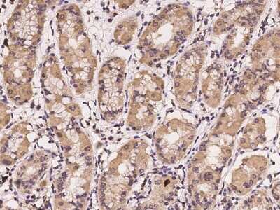 Immunohistochemistry-Paraffin: CHST12 Antibody [NBP2-97234]