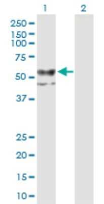 Western Blot: CHST12 Antibody [H00055501-B01P]