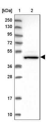 Western Blot: CHST12 Antibody [NBP1-91784]