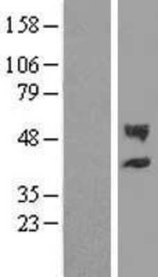 Western Blot: CHST12 Overexpression Lysate [NBL1-09194]