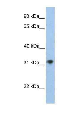 Western Blot: CHST13 Antibody [NBP1-62294]