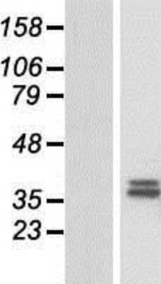 Western Blot: CHST13 Overexpression Lysate [NBP2-05301]