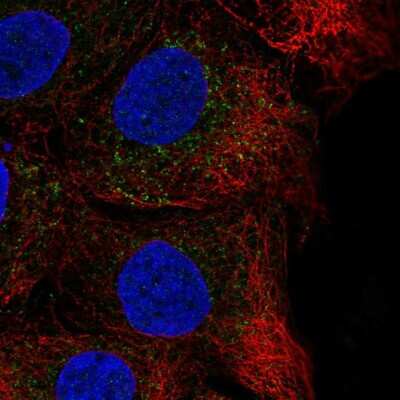 Immunocytochemistry/ Immunofluorescence: CHST14 Antibody [NBP2-56997]