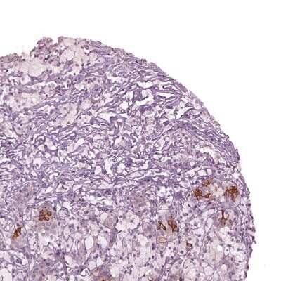 Immunohistochemistry-Paraffin: CHST14 Antibody [NBP2-57389]
