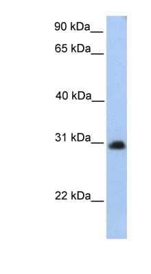 Western Blot: CHST14 Antibody [NBP1-55174]