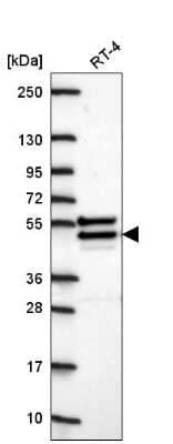 Western Blot: CHST14 Antibody [NBP2-57389]